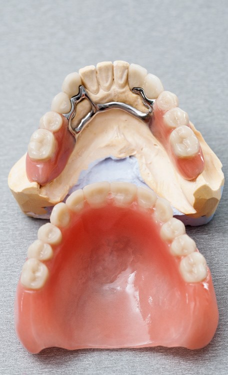 Metal Dentures Kings Bay GA 31547